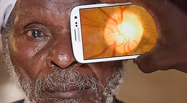 Exame de vista ONLINE! Confira agora a nova vantagem tecnológica para a sua saúde visual 